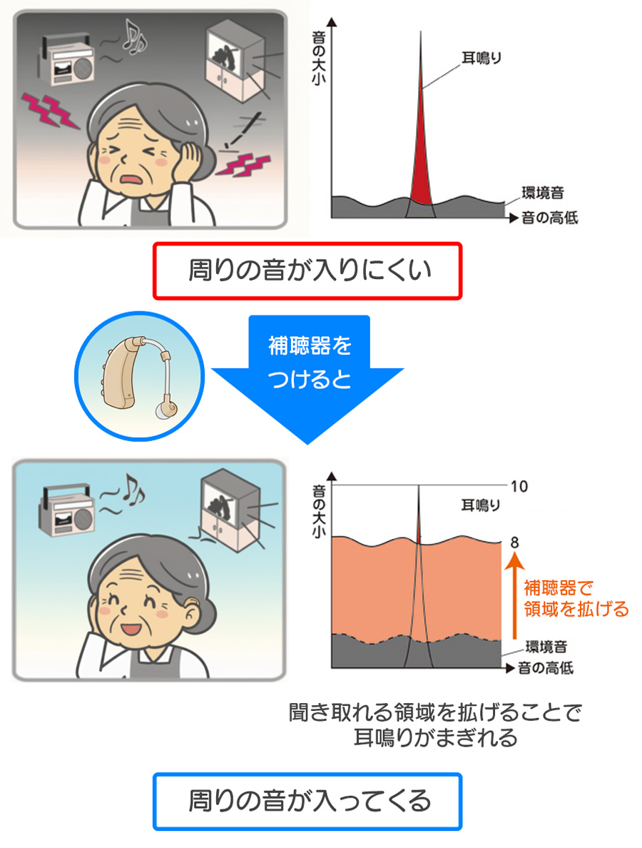 補聴器をつけると